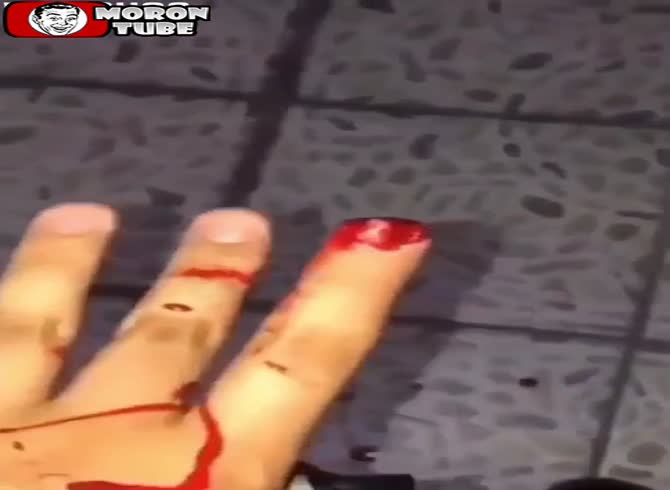 Video :She puts her finger in front of a rabid dog's mouth to try to calm him down, but it doesn't work! (Caution - startling)